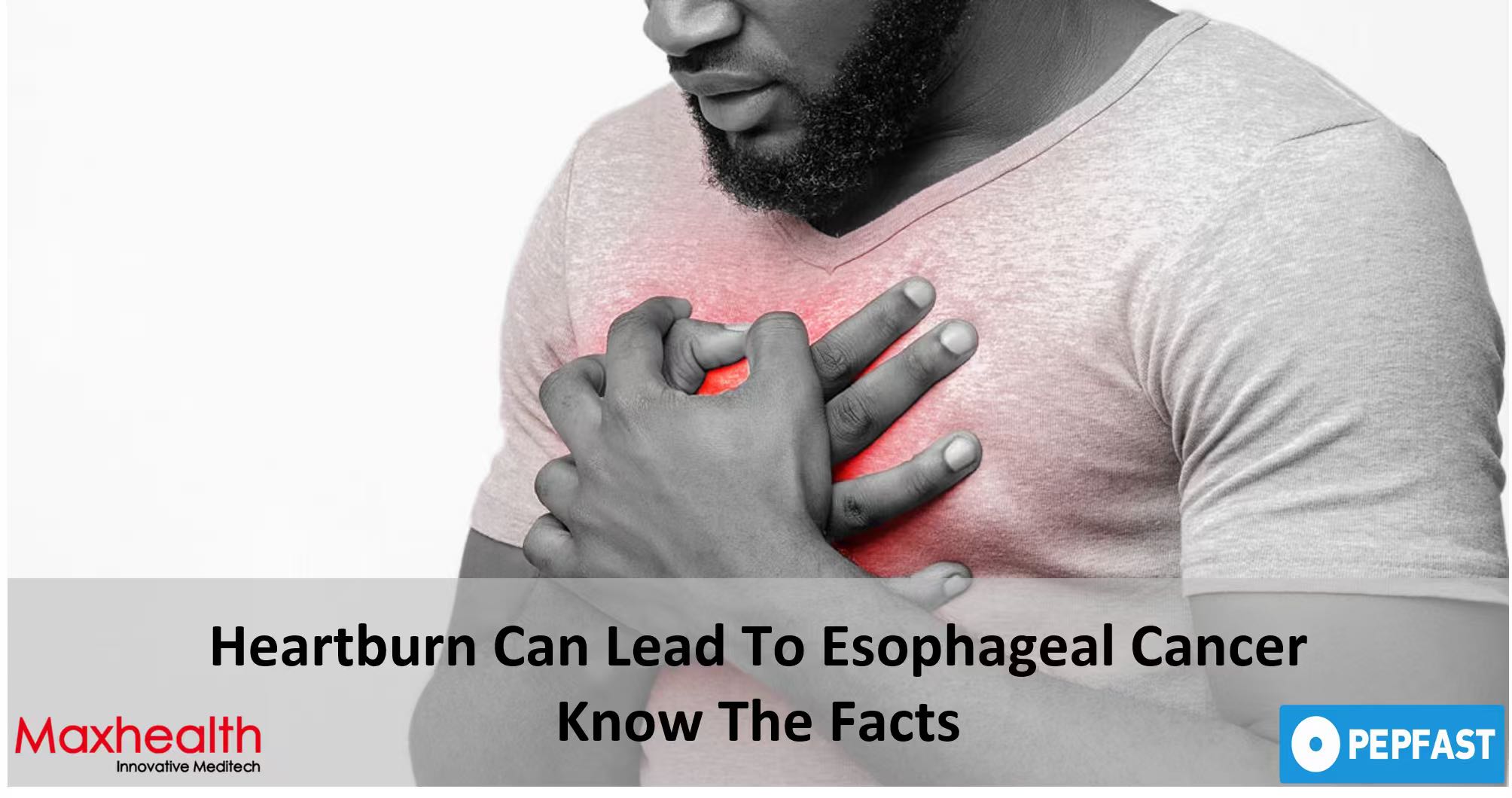 Der entscheidende Zusammenhang zwischen GERD und Speiseröhrenkrebs und ein neuer Weg zu mehr Klarheit